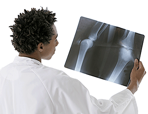 depuy attune knee lawyers