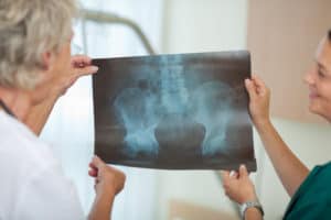 hip replacement lawyers