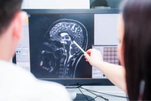 traumatic brain injury lawsuit