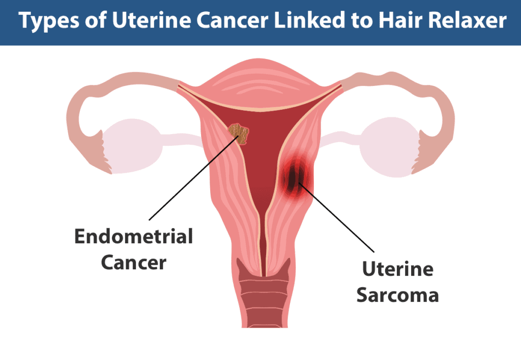 What types of uterine cancer are caused by hair relaxers
