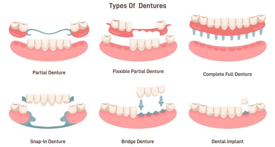 Suboxone Dentures Side Effects