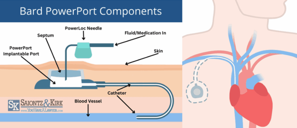 Bard PowerPort Components